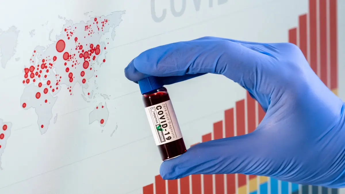 Navod Pro Vladu Jak Zbrzdit Epidemii Musi To Byt Prisnejsi Opatreni Seznam Zpravy