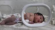 Video: Děvčátko narozené v sutinách je samá modřina, lékaři se bojí o míchu