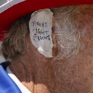 Ucho si zalepil například Duane Schingel (na snímku), který se tradičně na republikánských akcích strojí jako Strýček Sam. Na svou pásku si navíc napsal „Bojujte, bojujte, bojujte“, což jsou slova, která Trump pronesl ještě na pódiu poté, co ho zranil atentátník.