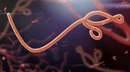 Ebola v Česku? Tohle není začátek epidemie, uklidňuje lékař