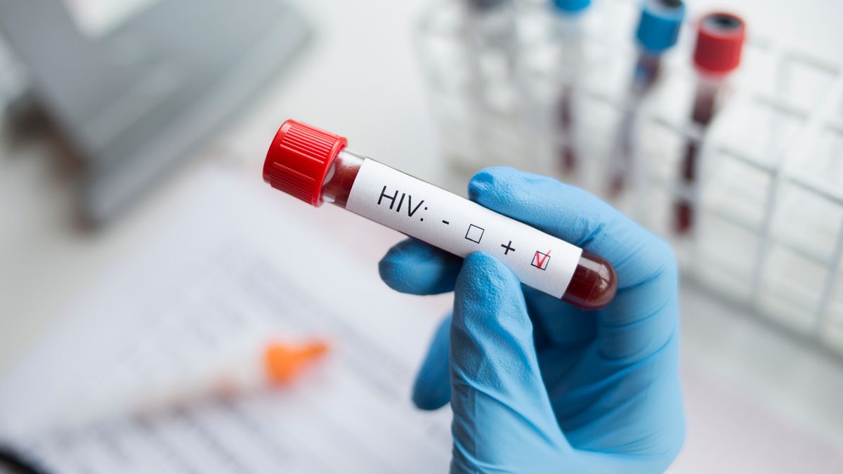 Případů HIV bylo v Česku loni nejvíc od roku 1985