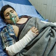 Místní novináři se domnívají, že vysoký počet obětí je způsobený i špatnou vybaveností nemocnic. Záchranná služba v nedalekém Mosulu nemá dost sanitek, v nemocnicích chybí personál i léky. Snímek popáleného chlapce v jedné z nemocnic, 27. září.