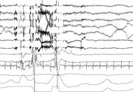 Všechny tyto hodnoty jsou zaznamenávány speciálním softwarem v podobě grafu.