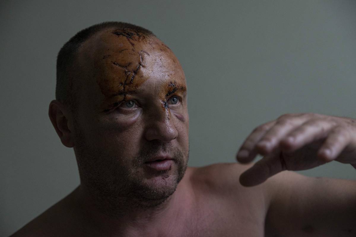 Snímek z 30. června 2022 z nemocnice v Kremenčuku, kam vozili zraněné po ruském raketovém útoku na místní nákupní centrum. Na nákupy se krátce před útokem vydal 45letý Nikolaj Michajlec s manželkou. Nikolaj (na snímku) utrpěl tržné rány, žena byla těžce zraněna a ve chvíli, kdy tato fotka vznikla, bojovala o život na jednotce intenzivní péče.