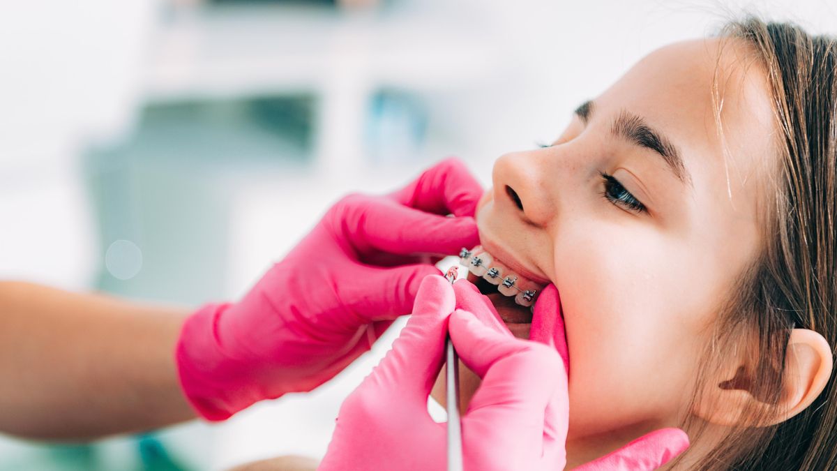 Pasienter betaler titusenvis for tannregulering.  Eksperter forklarer hvorfor