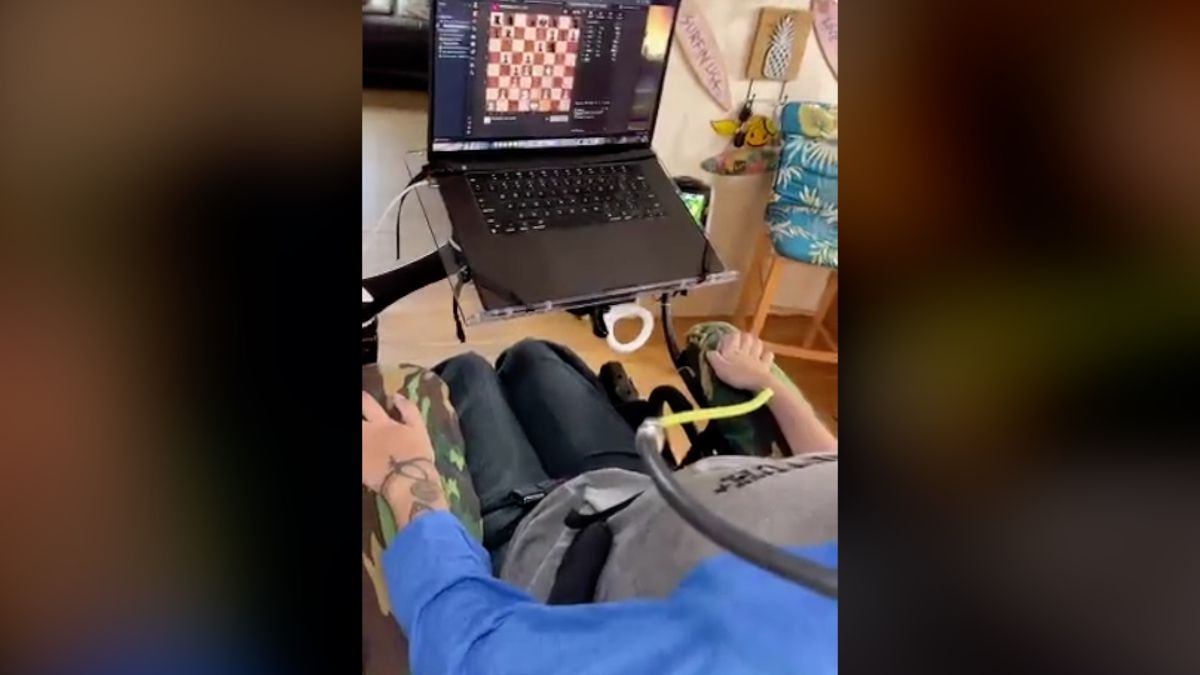 Video prvního člověka, který má v mozku čip od Neuralinku