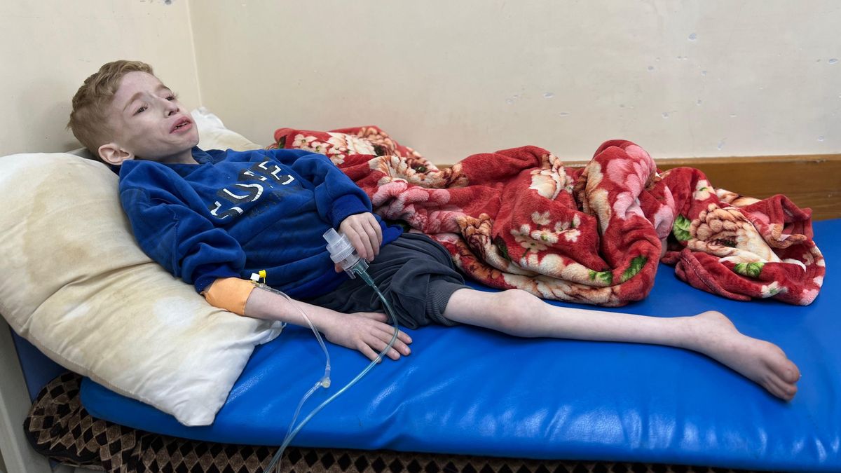 Smrtelně bledý, těžce oddechuje. Jak hlady umírají děti v Gaze