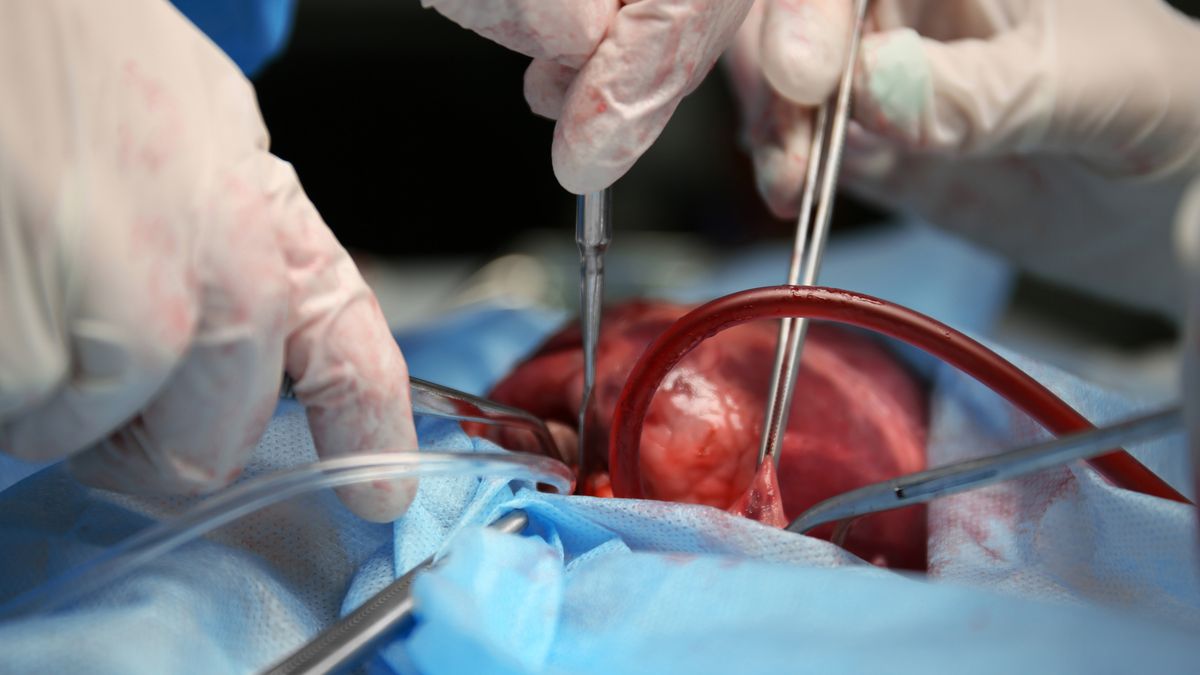 Nemocnice v USA oznámila první úspěšnou transplantaci prasečí ledviny člověku