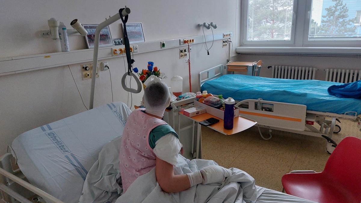 Lidé vybrali milion pro popálenou Lenku. Psychicky je na tom trochu hůř