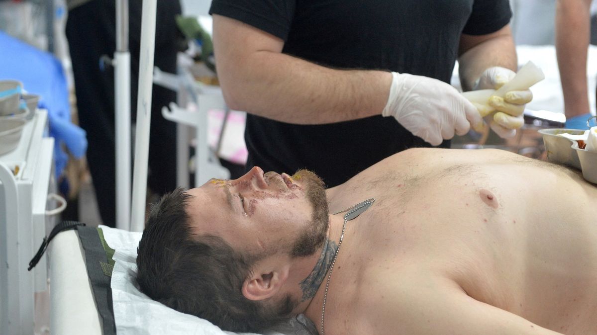 Ukrajinské superodolné bakterie jako varování. „Tichá pandemie“ bobtná i u nás