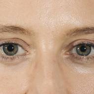 Alice Weidelová,  spoluvůdkyně AfD se přihlásila ke kontroverznímu termínu „remigrace“, který se používá pro označení plánu na rozsáhlé deportace přistěhovalců. Vyfoceno v německém Essenu, 30. června 2024.