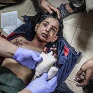 Vzhledem k tomu, že mezinárodním novinářům byl vstup do Gazy fakticky zakázán, válku dokumentují místní fotografové.

(Zraněný chlapec je ošetřován v nemocnici al-Aksá v Dajr al-Balah po izraelském útoku, 1. ledna 2024.)