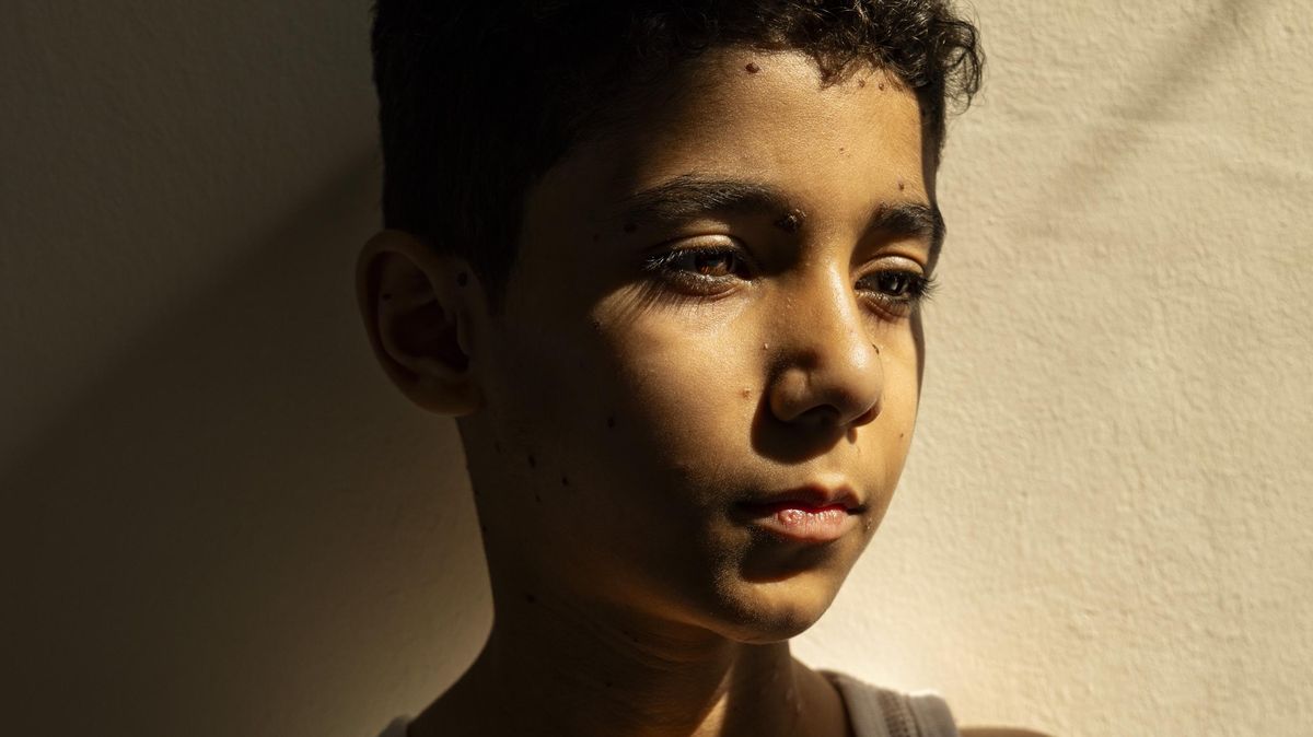 Letošní ročník World Press Photo vyhrál snímek z Gazy