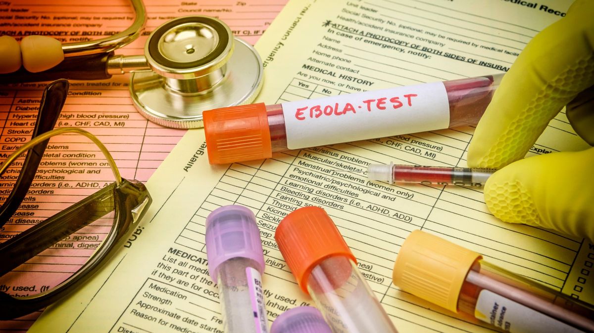 Postrach z nitra Afriky. Jak zabíjí a jak se šíří ebola