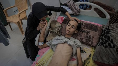 Gaza hladoví. Svaly se rozpadají, děti už přestávají plakat, říká lékař