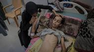 Gaza hladoví. Svaly se rozpadají, děti už přestávají plakat, říká lékař