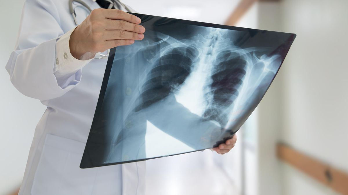 S bolestí břicha šla ke gynekologovi, vyšetření ale odhalila rakovinu plic