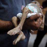 Muž nese tělo palestinského dítěte, které podle zdravotníků zemřelo v důsledku podvýživy. (Nemocnice Násir v Chán Júnis v jižní části Pásma Gazy, 26. července)