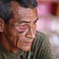 Zraněný je i synovec zemřelé ženy Wilman González (na snímku), prý skoro přišel o oko, potřeboval tři stehy. I on přišel o domov a teď neví, kam půjde. Z trosek svého domu zatím zachránil jen starý deštník a komodu.

(Catia La Mar, Venezuela, 4. ledna.)