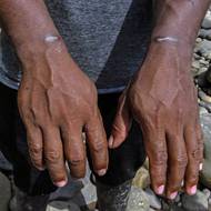 Ačkoli vláda trvá na tom, že její cíle byly součástí nelegální a vražedné sítě, místní obyvatelé vyprávějí jiný příběh.

(Zemědělec ukazuje zranění na zápěstích, která podle svých slov utrpěl, když byl spoután během protidrogové operace ekvádorské armády v oblasti Lago Agrio, vyfoceno 18. března.)