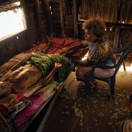 Dnes, kdy stoupající hladina moře vytlačuje komunitu a ohrožuje její budoucnost, představuje pěstování mořských řas ekonomickou alternativu k sezonnímu lovu. (Eddie Sua je již dva roky upoután na lůžko v chatrči, kterou při přílivu zaplavuje voda. Upozorňuje, že bez potravy a příjmů z prodeje delfíních zubů by komunita hladověla. Vesnice Fanalei, ostrov Fanalei, 16. února 2025.)