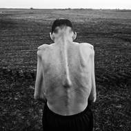 Tento projekt dokumentuje lidské náklady ekonomického modelu, který upřednostňuje zisky agroprůmyslu před životy obyvatel venkova. (Fabián Tomasi, bývalý pracovník v agrochemickém průmyslu, trpěl těžkou toxickou polyneuropatií a stal se celosvětovým symbolem boje proti agrotoxinům. Zemřel v roce 2018. Entre Ríos, Argentina, 25. října 2016.)