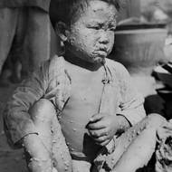 Díky globální očkovací kampani byly v roce 1980 oficiálně vymýceny. Přesto zůstávají symbolem toho, jak nebezpečné epidemie mohou být bez účinné prevence.

(Dítě s neštovicemi, 12. února 1946 v uprchlickém táboře v Číně.)
