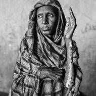 Porota ocenila příběh od Abdulmonama Eassy pro Le Monde. Revoluce v roce 2019 svrhla v Súdánu desetiletí trvající diktaturu, demokratické naděje ale v roce 2021 utnul vojenský převrat. O dva roky později se armáda a polovojenské síly obrátily proti sobě a rozpoutaly válku, z níž se stala jedna z nejhorších humanitárních krizí na světě. (Vysídlená žena z Bary ukazuje jizvy, které jí zůstaly po požáru v táboře Al-Mohad. Polovojenské jednotky zapálily několik táborů pro vysídlené osoby. 10. prosince 2025.)