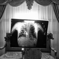 Více než 30 tisíc obyvatel čtvrti Wadi El-Qamar, známé také jako Měsíční údolí, žije méně než 15 metrů od cementárny, která plní jejich domovy toxickým prachem. (Amal drží rentgenový snímek svých plic. Do Wadi El-Qamar se přestěhovala ve třech letech a během několika měsíců u ní propuklo astma. 31. ledna 2018.)