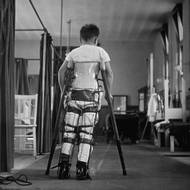 Vir dětské obrny byl naposledy v Česku evidován v roce 1960, virové onemocnění je způsobené poliovirem, který napadá nervový systém. V některých případech může dojít k trvalému ochrnutí, nebo i úmrtí.

(Dítě trpící dětskou obrnou se učí chodit s pomocí speciální opory v londýnské nemocnici Queen Mary's Hospital, 1947.)