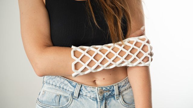 Nejenom bílá sádra, která svědí a zapáchá. Moderní medicína umí zlomeniny řešit pohodlně